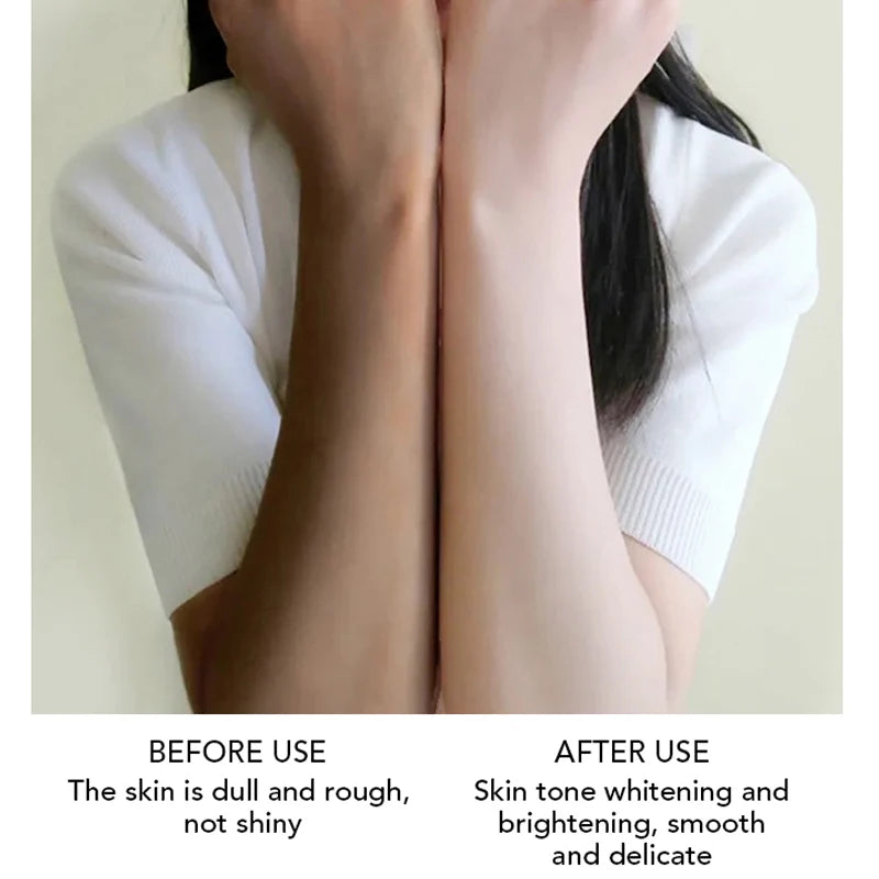 AILKE Black Spot Remover: Moisturizing lotion with Glutathione & Vitamin C for brighter skin.