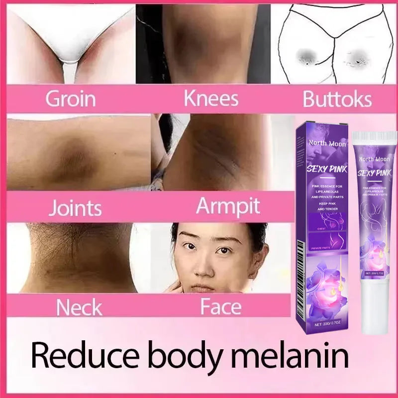 Nicotinamide Brightening Cream – Lighten Dark Spots & Even Skin Tone
