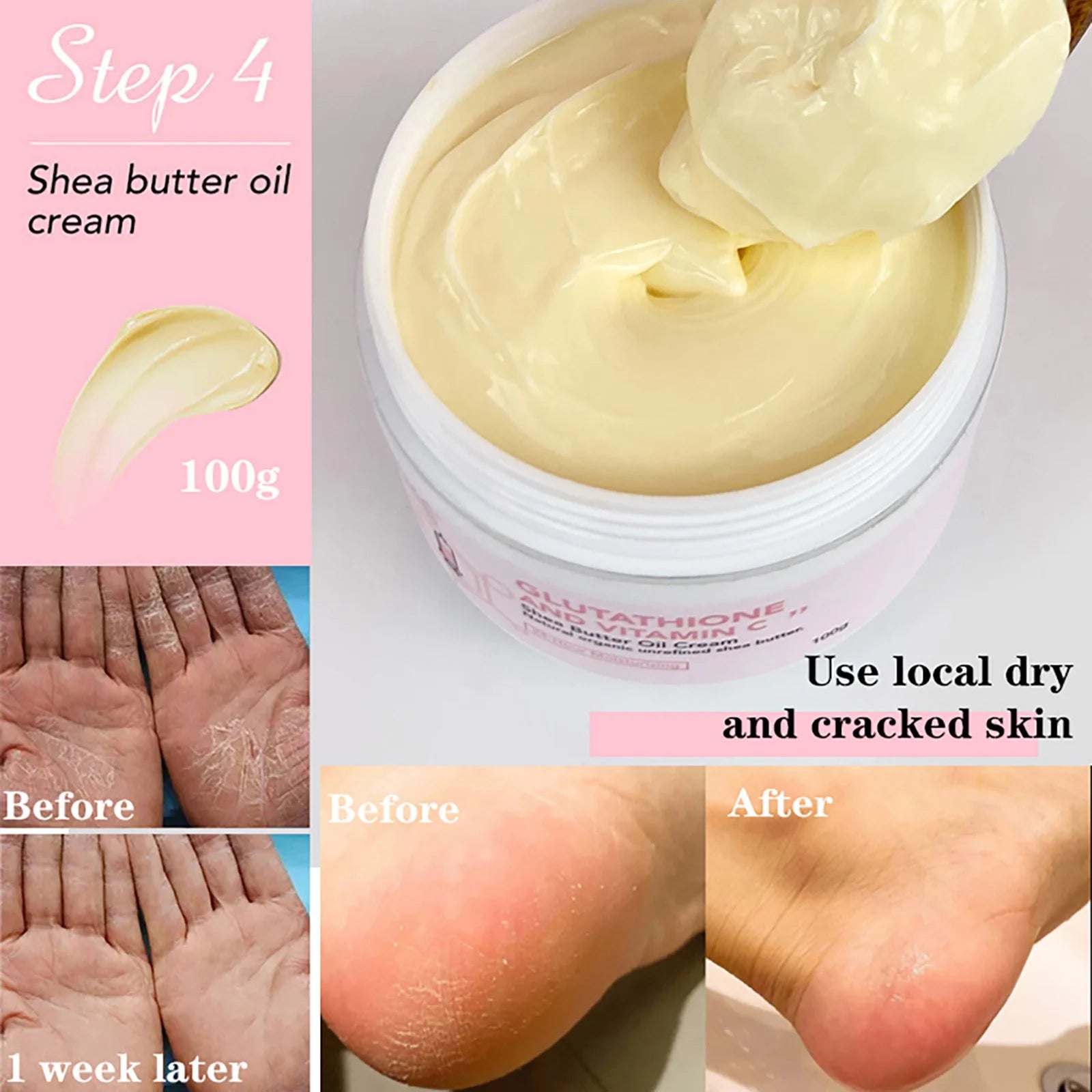 AILKE Black Spot Remover: Moisturizing lotion with Glutathione & Vitamin C for brighter skin.