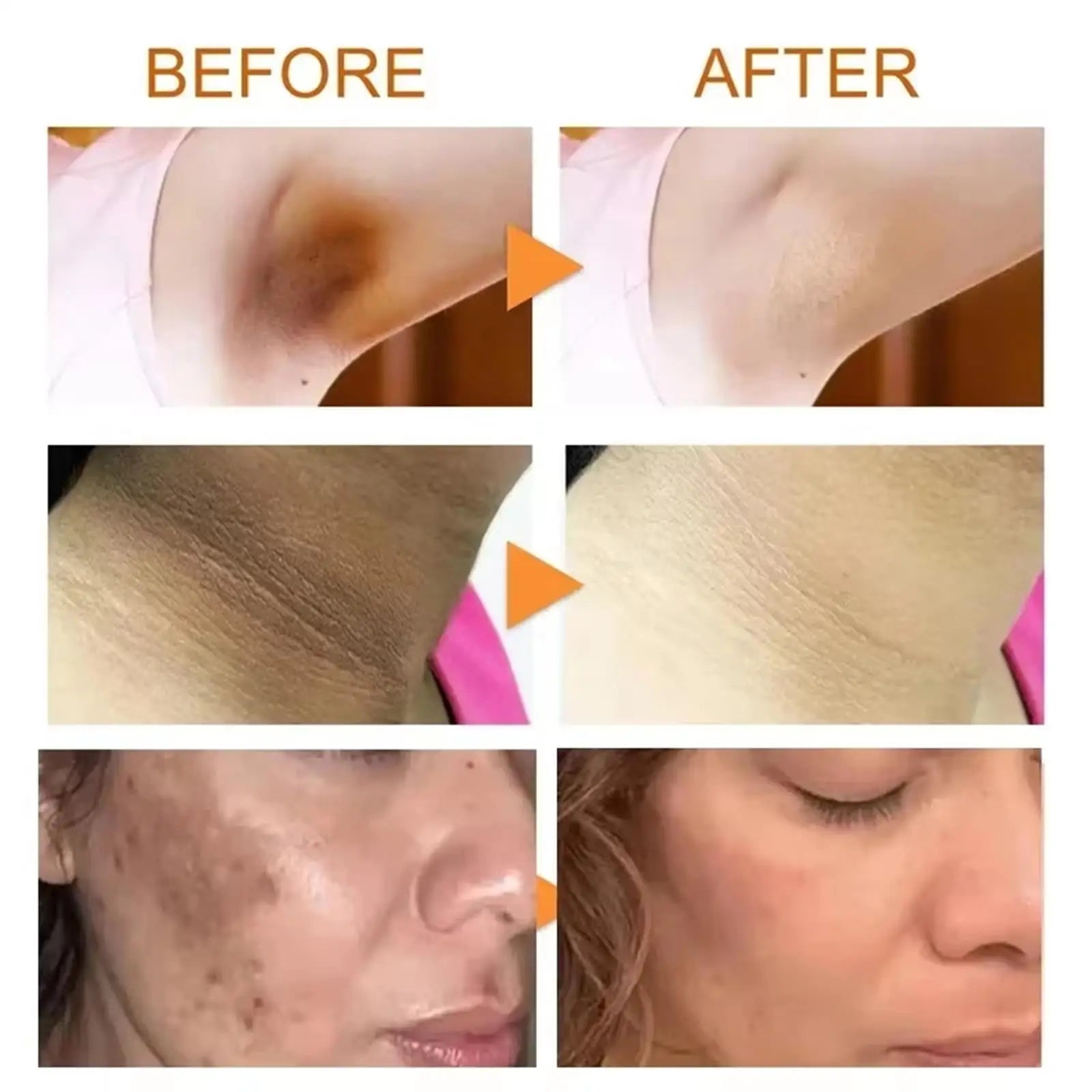 Nicotinamide Brightening Cream – Lighten Dark Spots & Even Skin Tone
